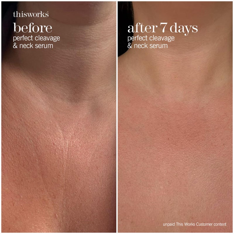 سيروم ذيس وركس المثالي لمنطقة الصدر والرقبة مع الطحالب البحرية وحمض الهيالورونيك - كريم للرقبة يشد ويرطب - 150 مل - Image 3